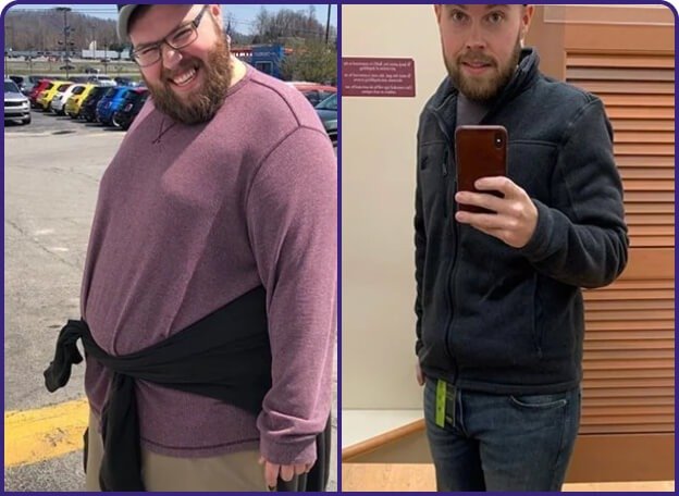 Before and after (customer 3)